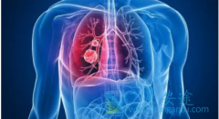 �����ΰ������˽�ΰ�����֢״��Ҫ���ļ������