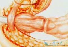 �ٴ�������ֱ����֢״���־����ű�ϰ�߸ı�