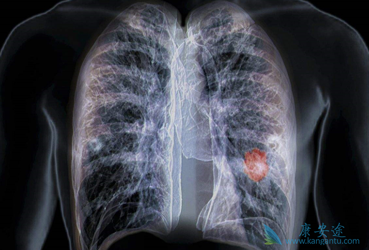 �ΰ�����֢״