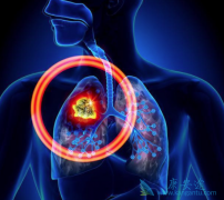 ��ʱ����Ե����Ƿΰ�����֢״����