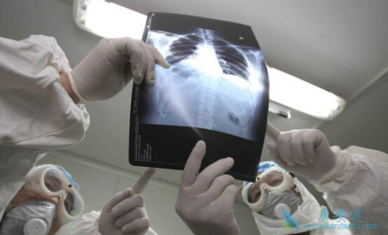 �ΰ���������