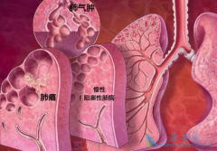 �ΰ�������ô���Ʋ����û��ߴ���ʱ�������