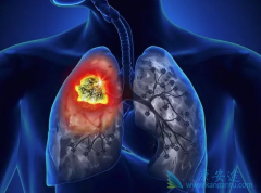 �ν�˲��˲������ص��ΰ����ڴ�Ⱦ��