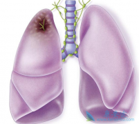 ר����ϸΪ�㽲��ΰ����ڻᴫȾ��