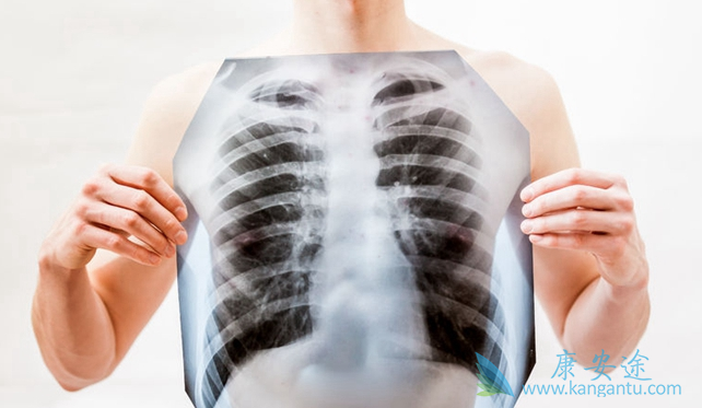 �ΰ������ܻ���