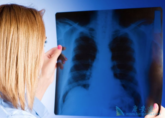预防肺癌复发 预防肺癌复发