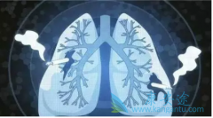 �ΰ�����֢״�ļ��ֳ����ľ������