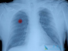 ���ڷΰ����ƺ���10��������Ͳ�����