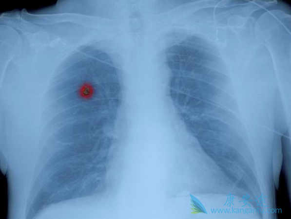 ���ڷΰ�����