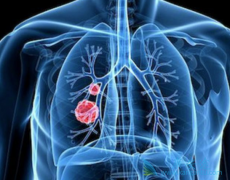 Ϊ������⼸�����ڷΰ������Ʒ���