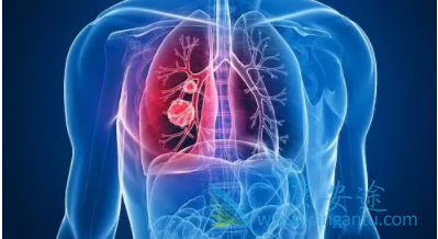 �ΰ����ڻ���