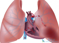 ���ڷΰ��������Ʒ����ɻ��Ⱙ֢�����ĸ�����