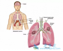 �ΰ������ڼ��ʲô�ɼ��ٻ��ƴ������˺�