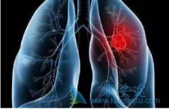 �ΰ�����֢״�ı�����Ҫ��������Щ������