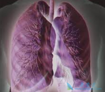 ���ڷΰ�ת�Ƶ�����ͷ������Ϊ�λ�Ƚϼ���