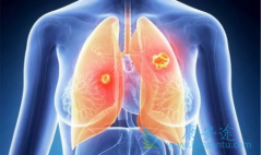 ���������˽�ΰ��ᴫȾ�����س�ʶ������