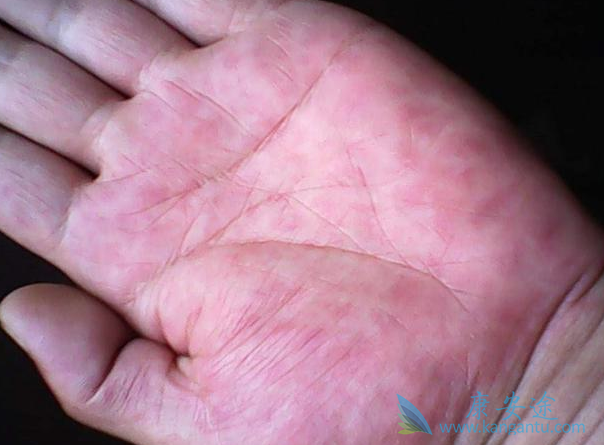 ����α���