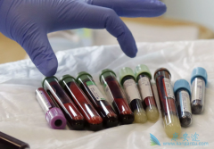 CAR-Tϸ����������ô��չ�����ڵģ���ôȥ����ʹ��CAR-T�Ʒ���