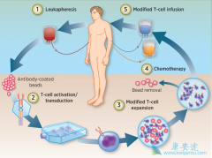 �ڹ�����Ҫ����CAR-Tϸ��������ô�죿����ȥ������CAR-T�Ʒ���
