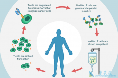 ��ҹ�˾�Ķ���CAR-T�Ʒ��ڲ�ͬ�İ�֢��������չ����������