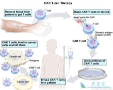 CAR-T�۸񰺹����������̵����������ϸ�