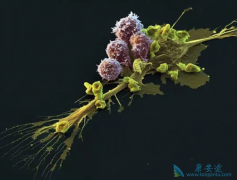 CAR-Tϸ���Ʒ�Kymriah�����ܰ���Ч�����