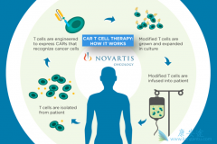 ������CAR-Tϸ�����Ʒ�������Щ���ƣ�CAR-T�Ʒ�Ч����ô����