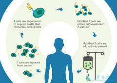 CAR-T�Էǰп�ԭ�Ľ��涾����Ӧ����Щ����ν��