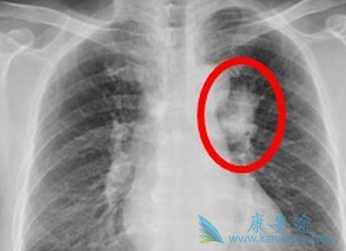 �ΰ�����