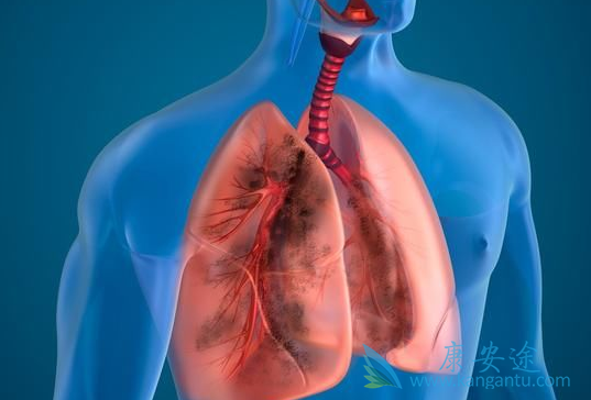 �ΰ�������ô����