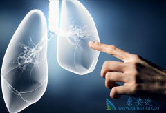 �ΰ�������֢״�ͷΰ����������Ʒ�����ʲô��