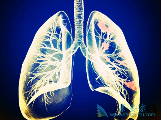 �ΰ���ת��