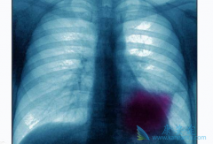 �ΰ��������ƿɴ�󽵵����ڷΰ����ߵ�ʹ��