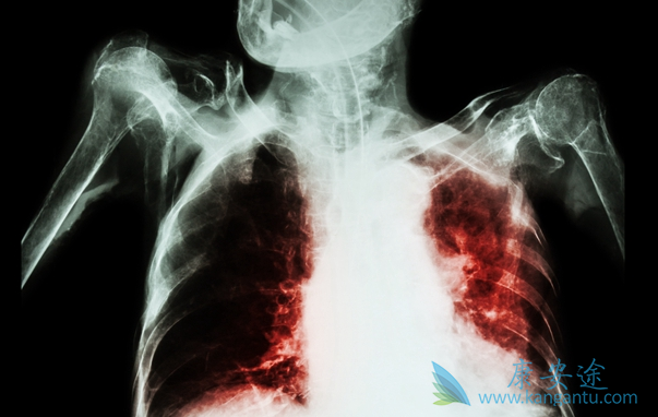 �ΰ����������κ���