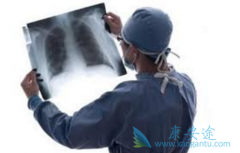 ����������Ϊ���Ʒΰ��ķ���֮һ��ʲô���ƣ�