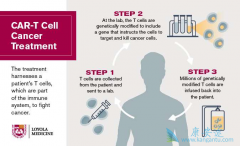 CAR-Tϸ�����Ʒ�����Ҫ�˷�ϸ�����ӷ籩�ķ���