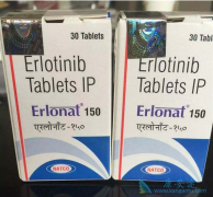 ӡ�����޿����صĸ�����һ����ʲô