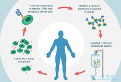 CAR-Tϸ�����Ʒ����Ǿ��л�ʱ������İ�֢���Ʒ�