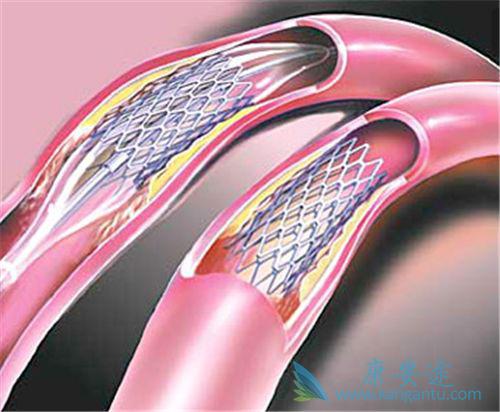 海外医疗 海外医疗