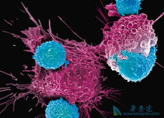 CAR-Tϸ���Ʒ��и�������CAR-Tϸ�������ڼ�Ӧע��Щʲô