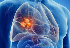 �ΰ���������ü�������(GEFITINIB)���Խ��͸���������