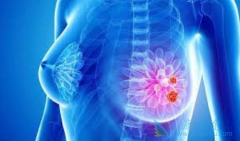 ��������(TYKERB)�����������ٰ�����ϣ�޴�����