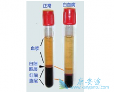 ��Ѫ������������Щ����Ѫ������ô����