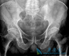 ���϶෢�Թ�������֢״����������ô����