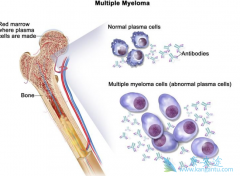 �෢���������Ѫ���ǲ���ͬһ���͵ļ���