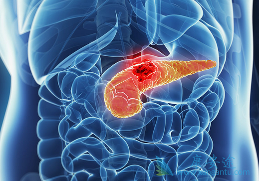 �������ٰ�