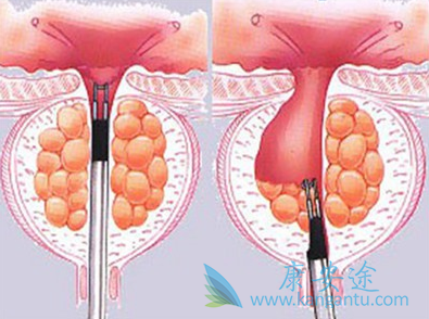 ǰ���ٰ��ܻ���