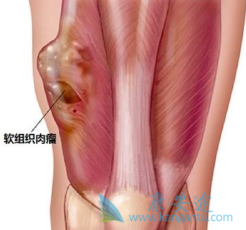 ����֯����