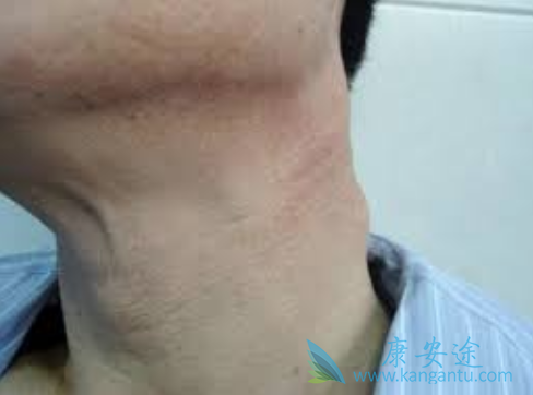 �ܰͰ����Ʒ���