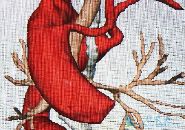 �����鵥��¡����